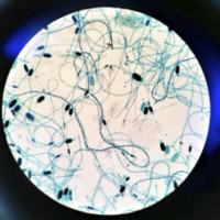 Photomicrograph of cyanobacteria. Author: Matthewjparke